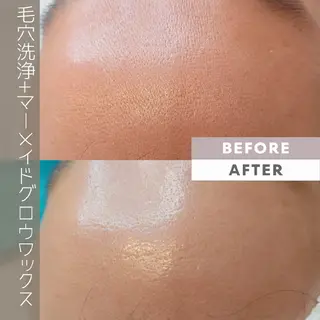 毛穴改善フェイシャル 夏秋美肌サロンのエステ・リラクイメージ