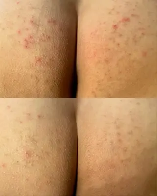 La・Bellvie所属・La･Bellvie 【星ヶ丘店]のエステ・リラクイメージ