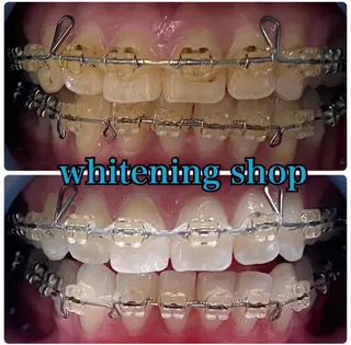 ホワイトニング ショップ津店のその他イメージ