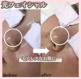 SALON韓国肌管理 東別院のエステ・リラクイメージ