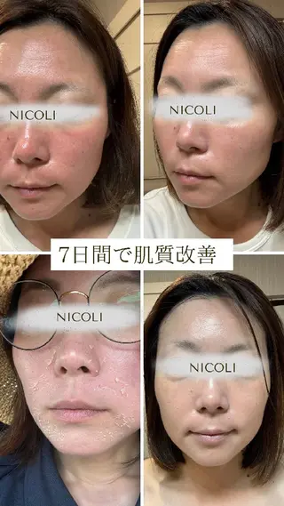 エステサロン NICOLIのエステ・リラクイメージ