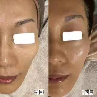 Liber【リベル】 AYAKAのエステ・リラクイメージ