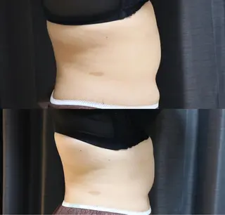 整♡深層リンパ ronronのその他イメージ