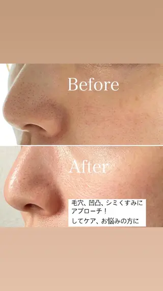 美肌&痩身&脱毛 MANAのエステ・リラクイメージ