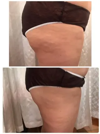 Aloha Mana 草加Ohana店のエステ・リラクイメージ