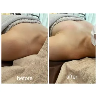 Rene 慢性疲労ケアサロンのエステ・リラクイメージ