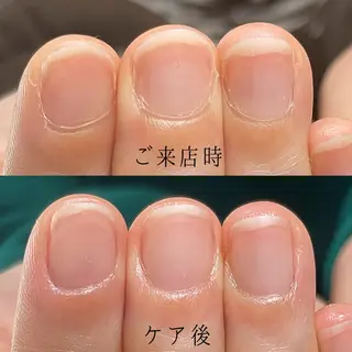 ネイル Aim* 深爪自爪育成専門店のネイルデザイン