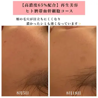 Bellesthe (ベルエステ)のエステ・リラクイメージ