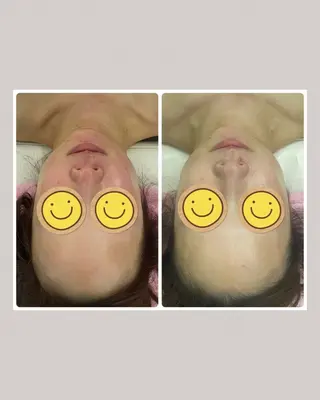 Salon Rion所属・Rion 野々村のエステ・リラクイメージ