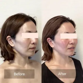 小顔・歪み専門　井元 朋子のエステ・リラクイメージ