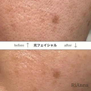 RuxuryNail ／RiAnnaのネイルデザイン