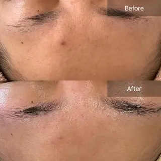 堀井 舞琳のエステ・リラクイメージ