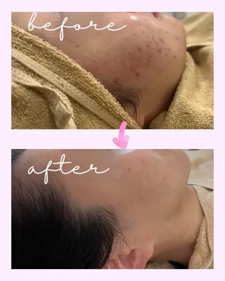 ｍｉkｉ 東根の肌質改善サロンのエステ・リラクイメージ