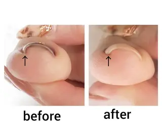 ネイル Nail Rinonのネイルデザイン