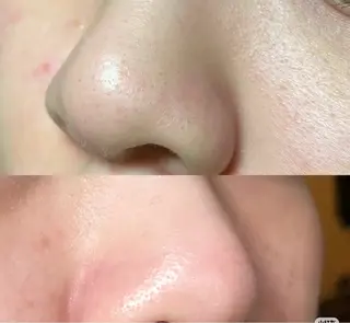 マツエク・マツパ 愛維美水光美肌専門店所属・愛維美水光美肌専門店 メンズレディースokのエステ・リラクイメージ