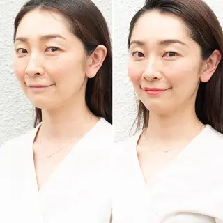 東京広尾|小顔矯正 ヘッドマッサージのエステ・リラクイメージ