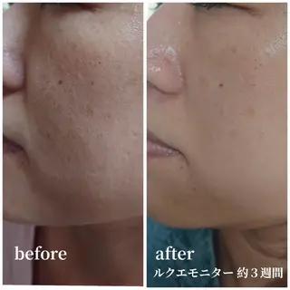 nozomi.m🌷 narisのエステ・リラクイメージ