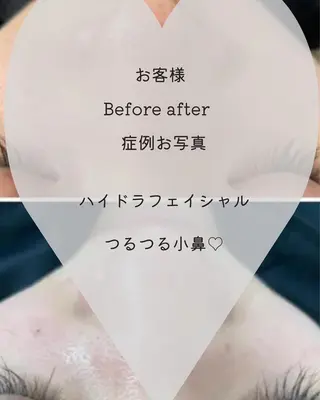 E LINDAのネイルデザイン