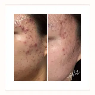 Toujours トゥジュールのエステ・リラクイメージ