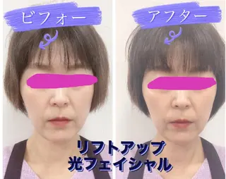 ショールームエステ becoのエステ・リラクイメージ