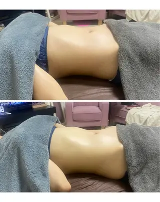 セルライトクラッシュ ＆腸もみ＋骨盤矯正のその他イメージ