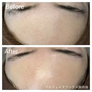 深い肌悩み専門 フェイシャルサロンのエステ・リラクイメージ