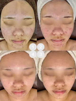 Nicore所属・肌質改善🌿まつ毛 chapiのその他イメージ