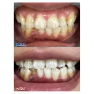 Ｍ渋谷 ホワイトニングのエステ・リラクイメージ