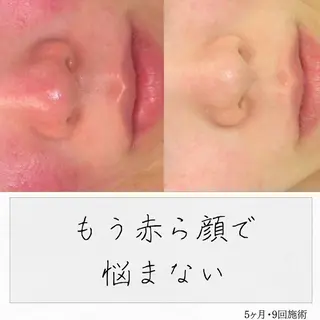 ニキビ経験者が施術 する専門サロン🌻のエステ・リラクイメージ