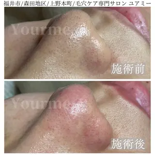 毛穴肌質ケアサロン Yourmeユアミーのエステ・リラクイメージ