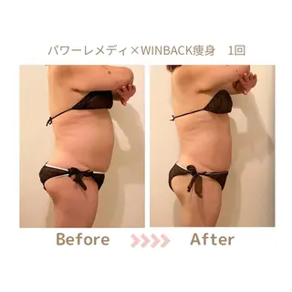 肌質改善×小顔サロン リトリト垣内のエステ・リラクイメージ