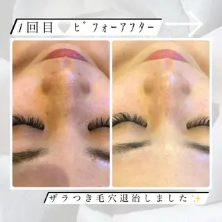 T. Kasumiのネイルデザイン