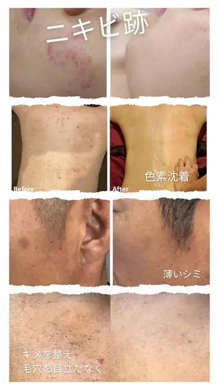 井上 みあのエステ・リラクイメージ