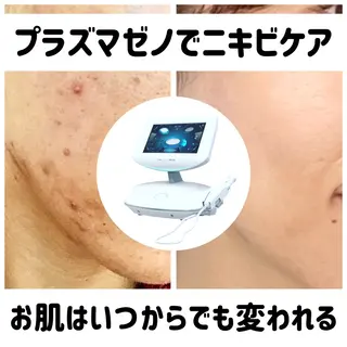 小顔★美肌★ 平日限定★¥6600のエステ・リラクイメージ
