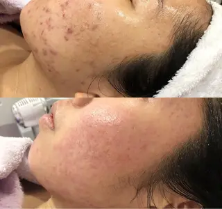 井戸 美奈子のエステ・リラクイメージ