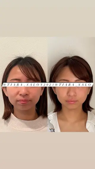 鍼灸サロン TIARA　美容鍼のエステ・リラクイメージ