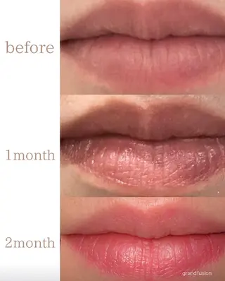 ロゼ ブランシュのエステ・リラクイメージ