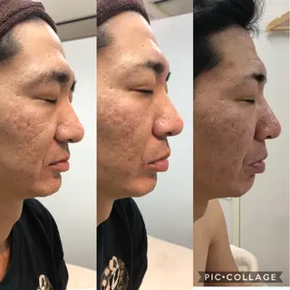 トータルビューティーサロン LilyRose所属・エステサロン LilyRoseのエステ・リラクイメージ