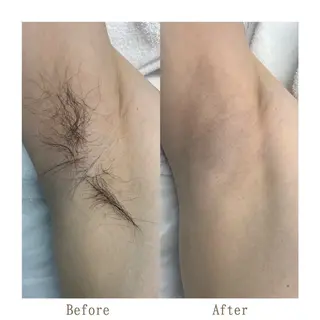 サキ 脱毛.エステ🩵ྀིのエステ・リラクイメージ