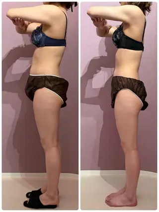 アンベリーノ Yuuriのエステ・リラクイメージ