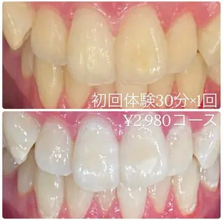 メンズ ホワイトニング ルーム　川崎店のその他イメージ