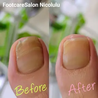 足トラブル専門 ニコルル金沢のエステ・リラクイメージ