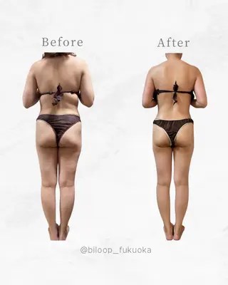 《本気痩せ×疲労改善 》  BILOOPのエステ・リラクイメージ