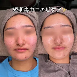メンズ マツエク・マツパ アイブロウ dazzle M🫧のマツエク・マツパデザイン