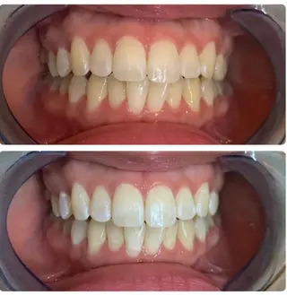 セルフホワイトニング サクッとホワイト 立川店所属・サクッとホワイト 立川店のその他イメージ