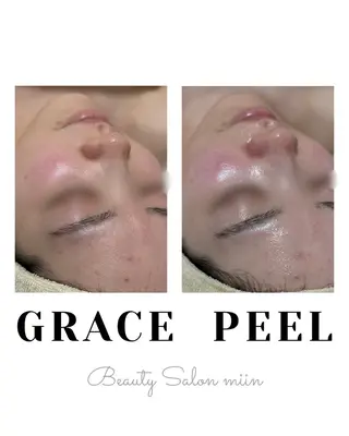 韓国肌管理 白玉肌管理®︎のエステ・リラクイメージ