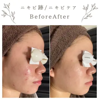 な ぎのエステ・リラクイメージ