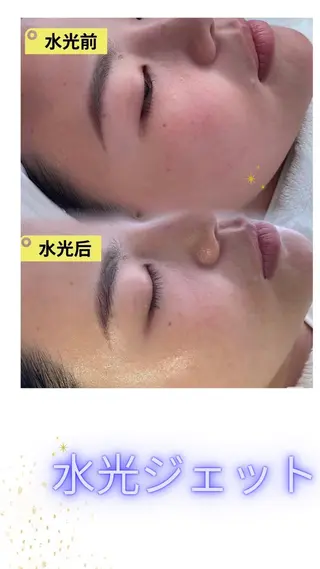 マツエク・マツパ 愛維美水光美肌専門店 メンズレディースokのエステ・リラクイメージ