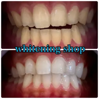 メンズ ホワイトニング ショップ川越店のエステ・リラクイメージ