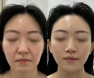 マツエク・マツパ aliaハイフ&水光ジェットサロン所属・aliaハーブ水光店 エステティシャン募集のエステ・リラクイメージ